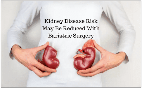 POSITIVE IMPACT OF BARIATRIC SURGERY ON KIDNEYS: A SWEDISH STUDY FINDINGS