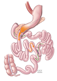 Duodenal Switch Gastric Bypass Anatomy