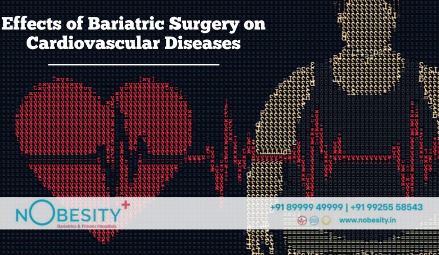 Effects of Bariatric Surgery on Cardiovascular Diseases