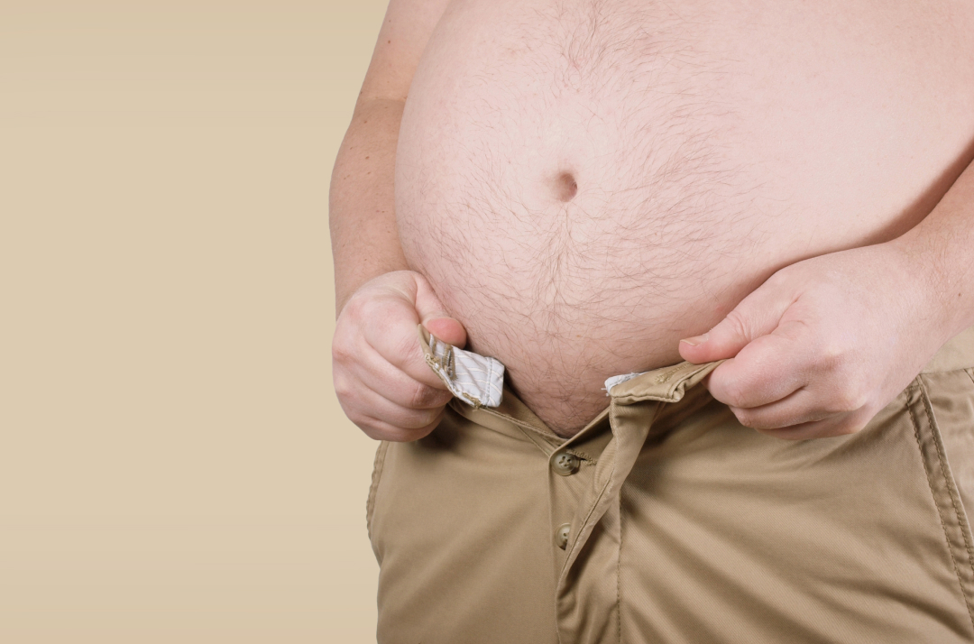 An obese person