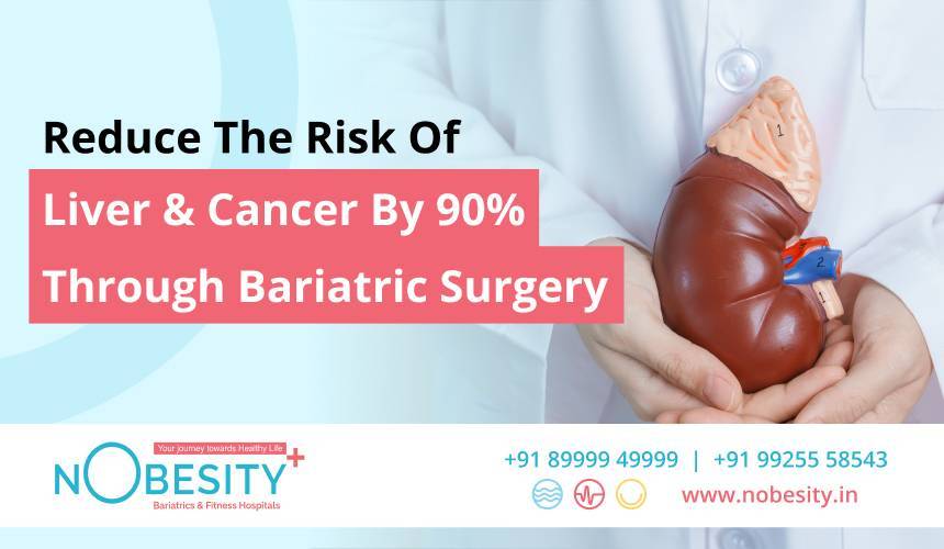 Reduce The Risk Of Liver & Cancer By 90% Through Bariatric Surgery