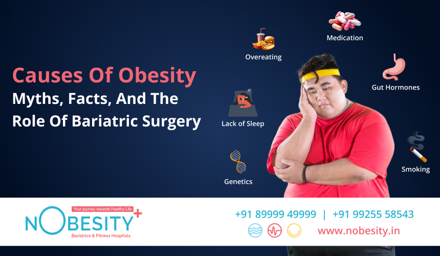 Causes Of Obesity: Myths, Facts, And The Role Of Bariatric Surgery