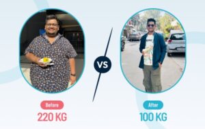 Bariatric-Surgery